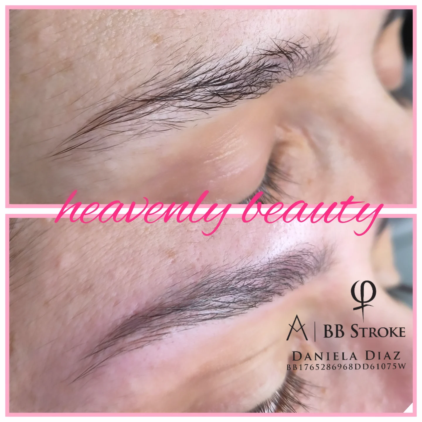 BB Stroke – Vorher/Nachher Ergebnis